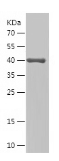 Recombinant Human RYR2/人源RYR2蛋