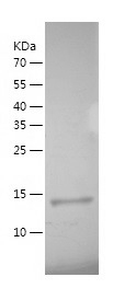 Recombinant Human BRPF1/人源BRPF
