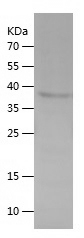 Recombinant Human TACC1/人源TACC