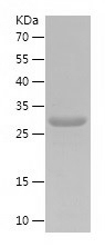 Recombinant Human UCHL3/人源UCHL