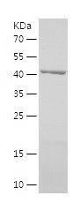 Recombinant Human MRPS22/人源MRP