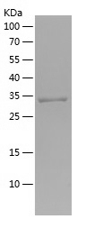 Recombinant Human MTARC2/人源MTA