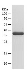 Recombinant Human LRP2BP/人源LRP