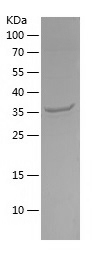 Recombinant Human ATP5F1C/人源AT