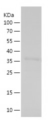 Recombinant Human HIST1H1C/人源H
