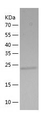 Recombinant Human NTMT1/人源NTMT