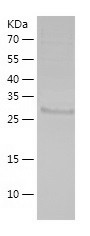 Recombinant Human PLEKHG3/人源PL