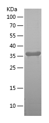 Recombinant Human SLITRK6/人源SL