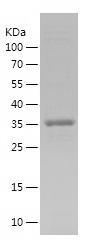Recombinant Human SLC2A3/人源SLC