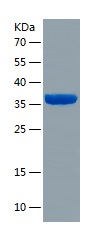 Recombinant Human METTL9/人源MET