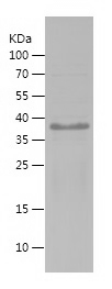 Recombinant Human SIRT1/人源SIRT
