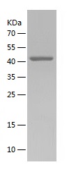 Recombinant Human Serpin B1/人源