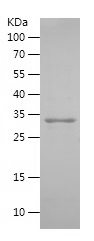 Recombinant Human UPK2/人源UPK2蛋