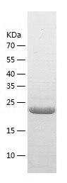 Recombinant Human LAT2/人源LAT2蛋