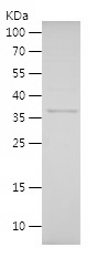 Recombinant Human STMN1/人源STMN