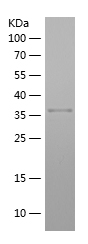 Recombinant Human HNRNPA3/人源HN