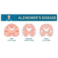 重组人Tau441蛋白 | Recombinant Human Tau441, phosphorylated