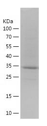 Recombinant Human S100A11/人源S1