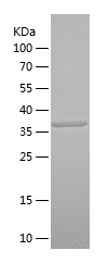 Recombinant Human SPINT1/人源SPI