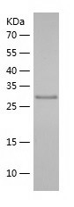 Recombinant Human TAF15/人源TAF1