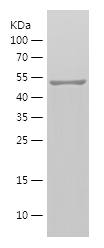 Recombinant Human MMP2/人源MMP2蛋