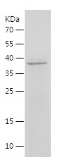 Recombinant Human DHRS3/人源DHRS