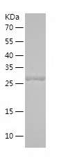 Recombinant Human SULT1A2/人源SU