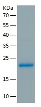 Recombinant Human CYB5B/人源CYB5