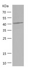 Recombinant Human ITPK1/人源ITPK