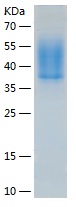 Recombinant Human IL-4R/人源IL-4