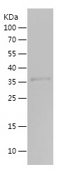 Recombinant Human MMP20/人源MMP2