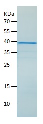 Recombinant Human HNRNPAB/人源HN