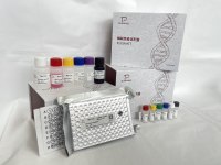 猪瘟病毒抗体(CSFV-Ab)ELISA检测试剂盒