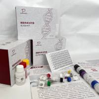 人(Human)可溶性甘露糖结合凝集素2(MBL2)ELISA检测试剂盒