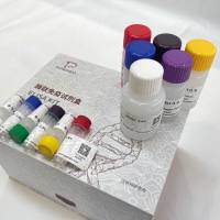 人(Human)硒结合蛋白1(SELENBP1)ELISA检测试剂盒