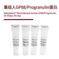 重组人GP88/Progranulin蛋白 | Recombinant Human GP88/Progranulin, 18-593aa, His-tag