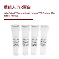 重组人TYR蛋白 | Recombinant Human TYR Protein, 274-475