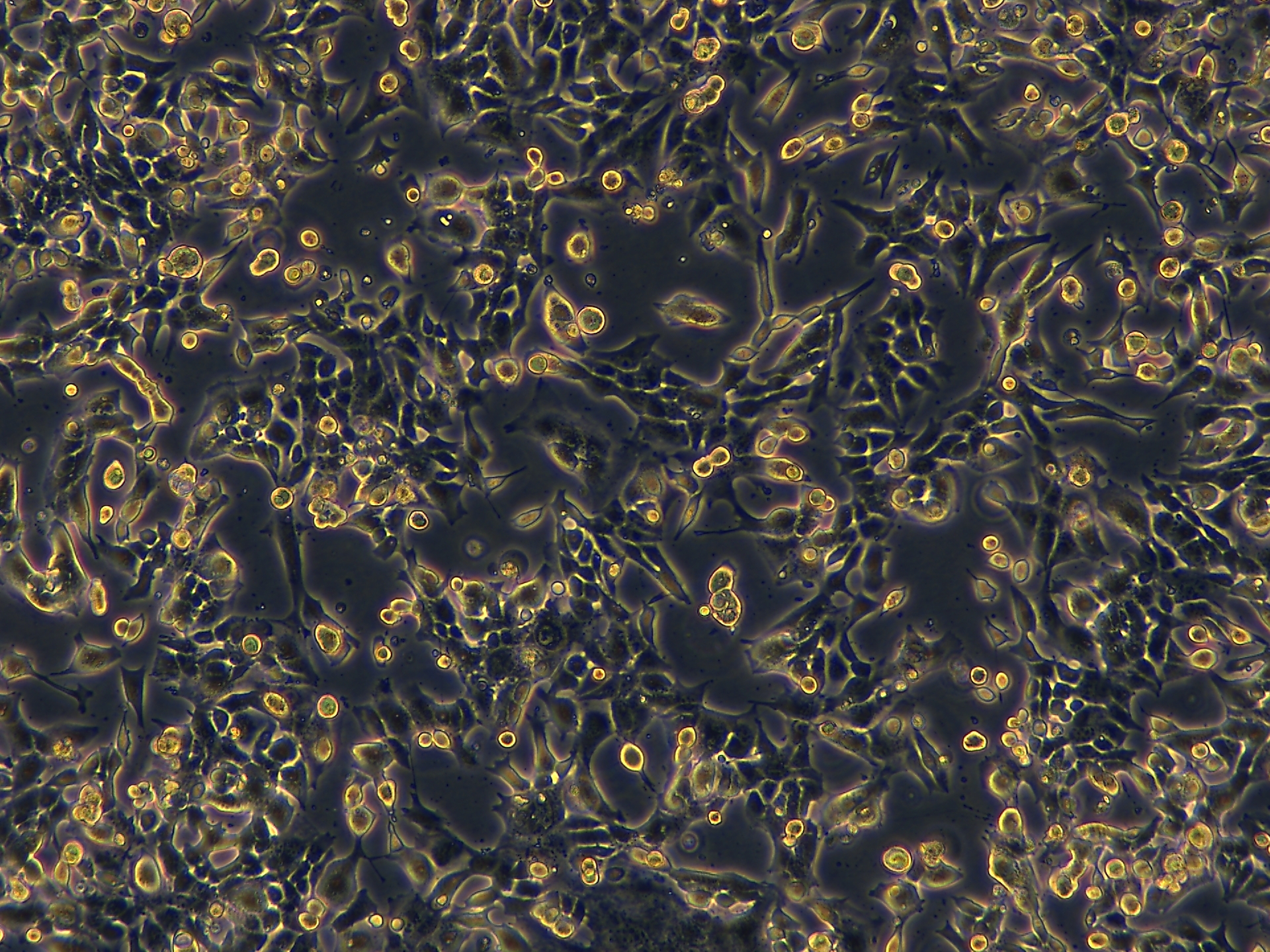 Project1001_GL261  10X_ch00.jpg