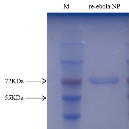 埃 博拉病毒重组核衣壳蛋白