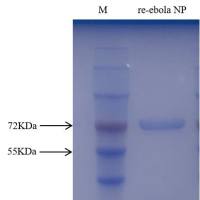 埃 博拉病毒重组核衣壳蛋白