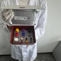 人(Human)乙型脑yan病毒IgM抗体(JEV-IgM)ELISA检测试剂盒