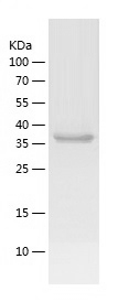 Recombinant Endonuclease V/重组E
