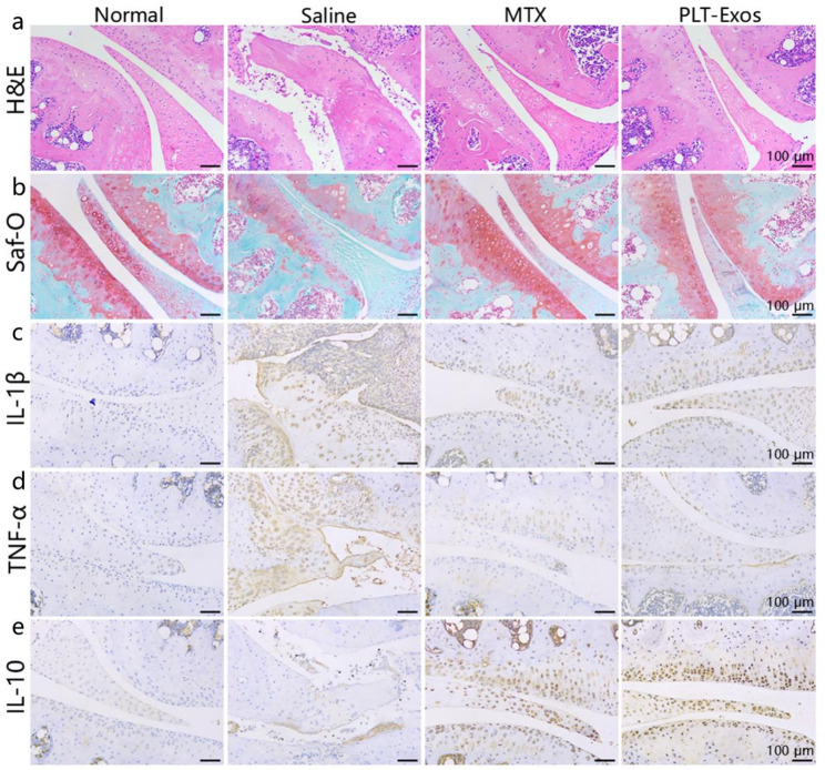 免疫组化检测 免疫组化检测