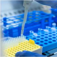 ELISA试剂盒免费代测