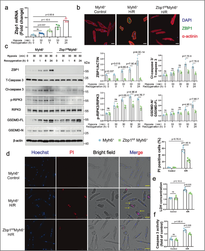 6389802452857169375470194