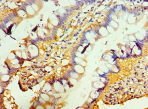 CSB-PA023971DSR2HU IHC1