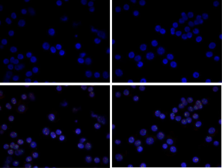 基于CD138免疫磁珠分选技术提升荧光原位杂交（FISH）的诊断效率的解决方案