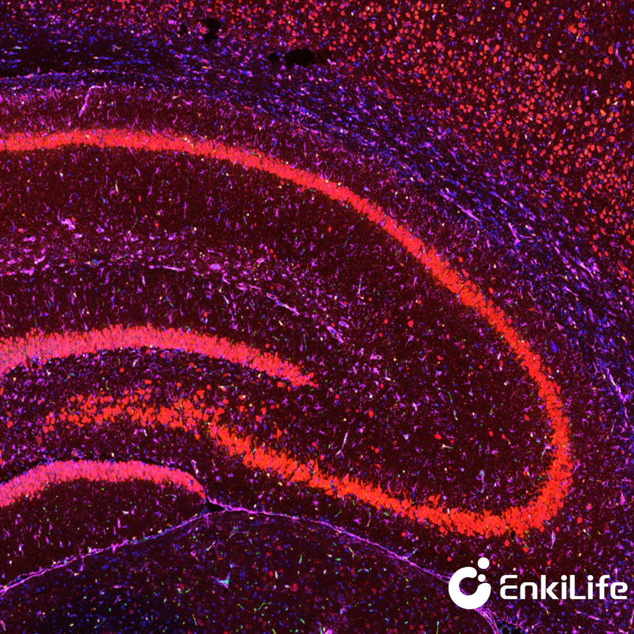 TSA六标七色多重荧光染色试剂盒(mIHC)