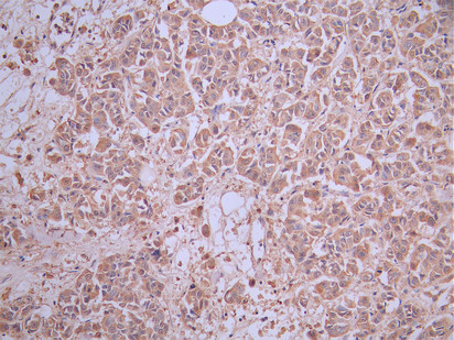 CSB-RA004935A0HU IHC