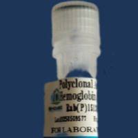 DNA聚合酶残留RT活性抑制剂/Inhibitor of Residual RT Activity of DNA Polymerase